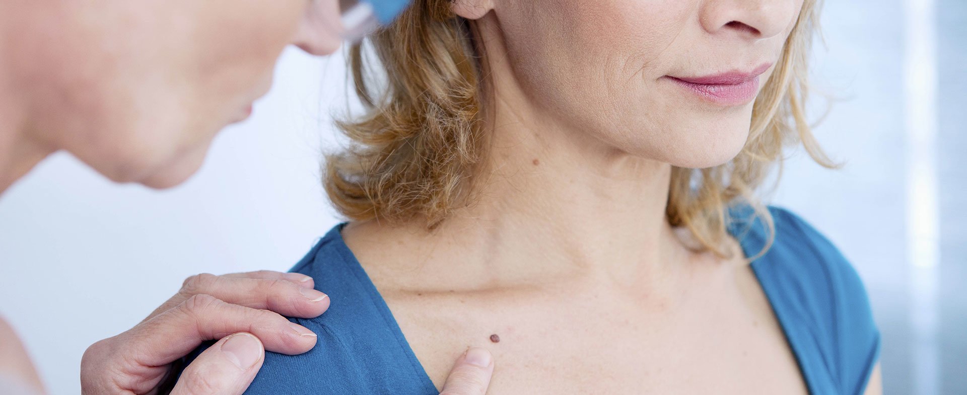 skin cancer screening 1