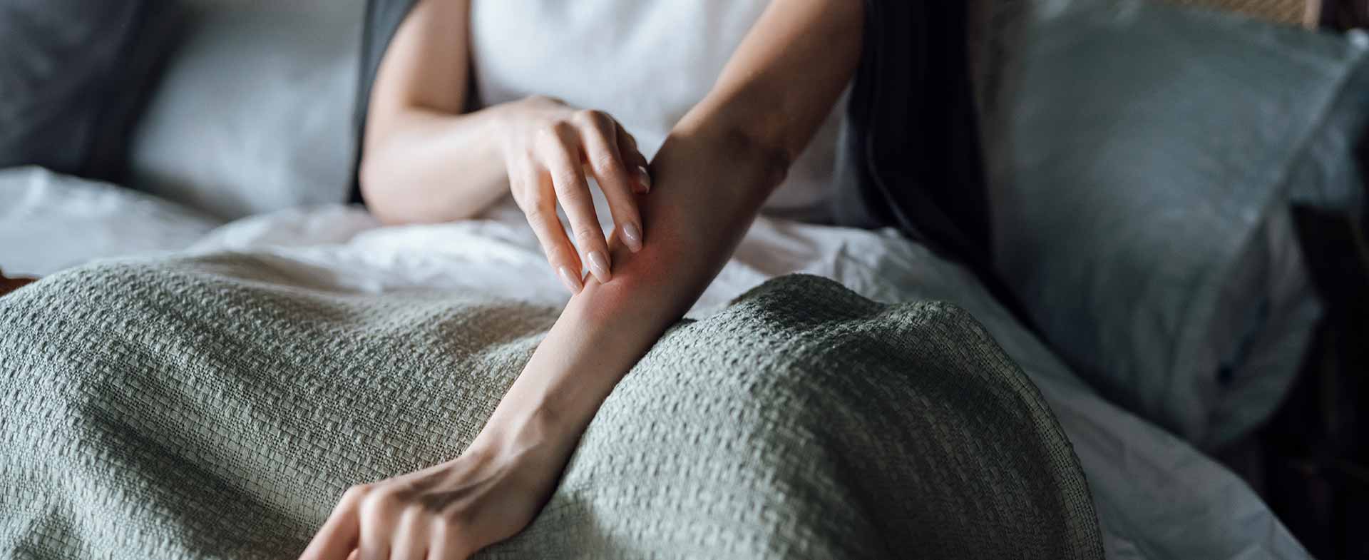 A person resting in bed gently touches their forearm, which shows a red rash. The bed is covered with a textured green blanket. hives