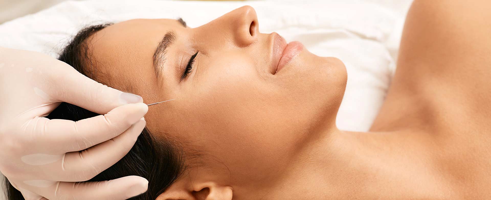 cosmetic acupuncture