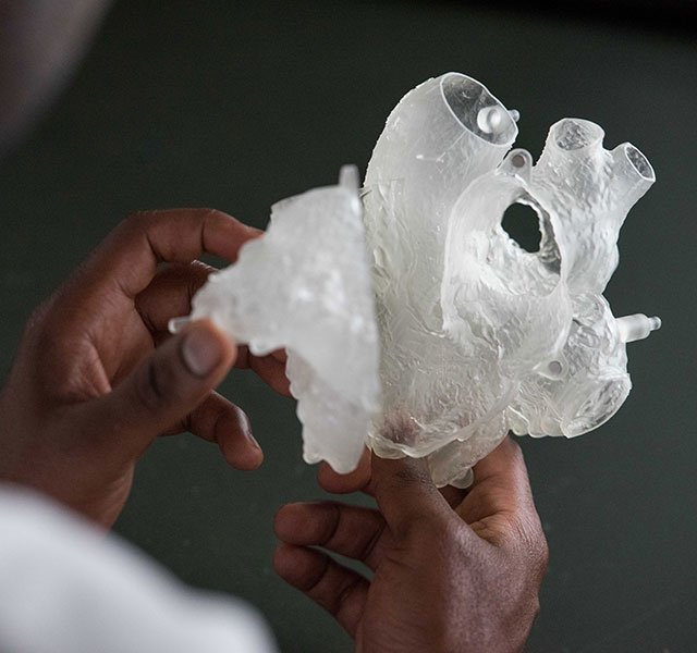 doctor holding heart model (1)