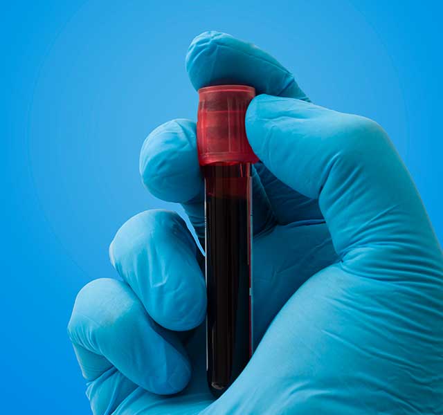 Blood test