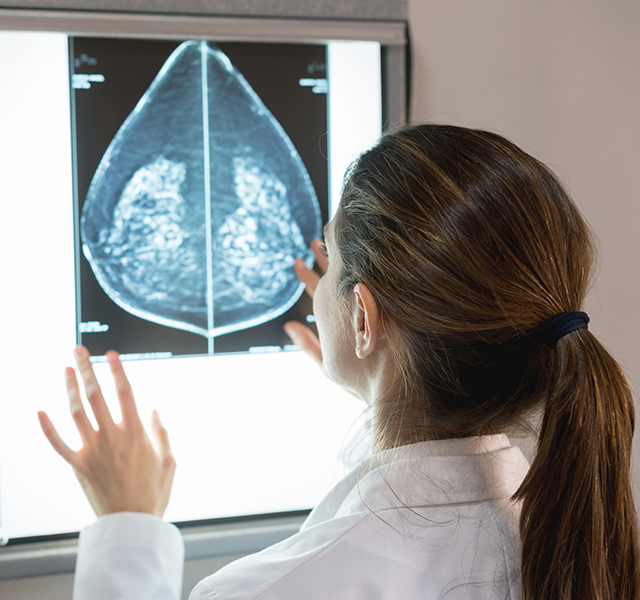 dense breasts on mammogram