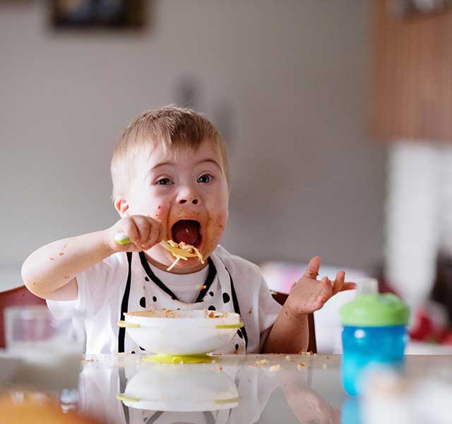 eating challenges down syndrome