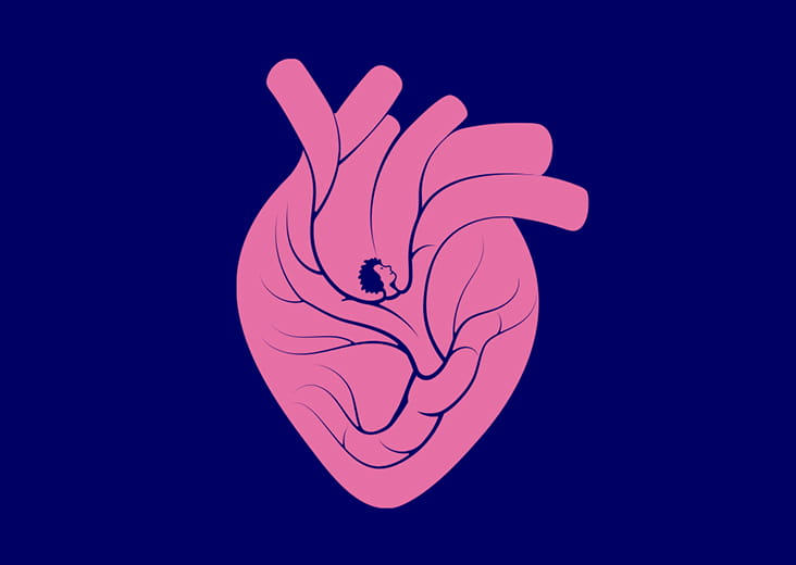 Where Advanced Heart Failure Fails