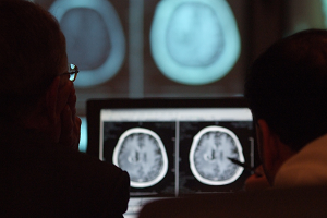Doctors review a brain scan