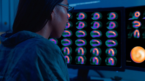 Woman looking at PET scans